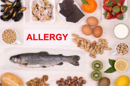 Keeping your customers safe: The importance of understanding food allergens and intolerances